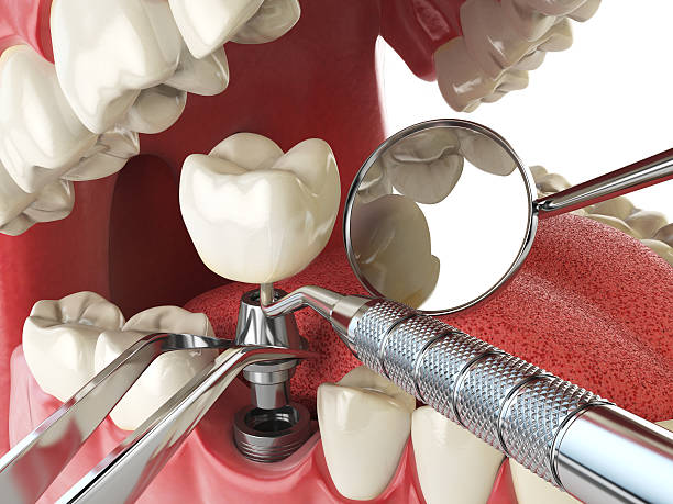 Best Emergency Dental Care for Trauma or Injury in Iola, WI